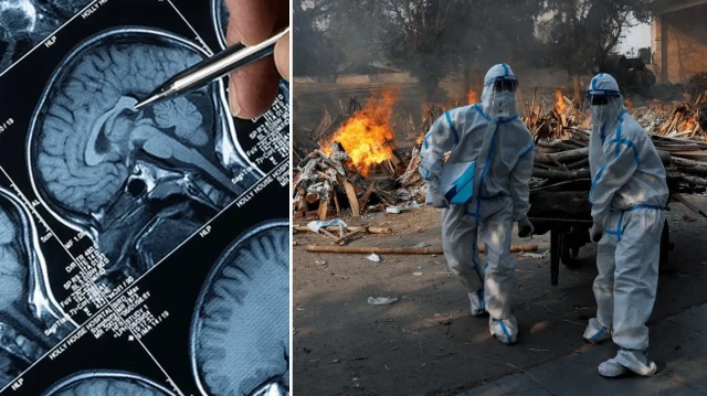 hindistanda beyin yiyen amip alarmi burundan giriyor yavas yavas beyni yiyor s9FIZglp